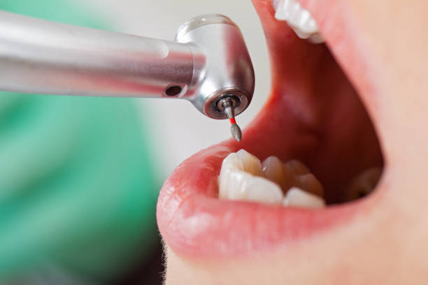 Best Cracked Tooth Emergency Dentist  in Jennerstown, PA